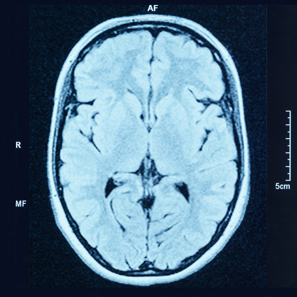 Brain CT scan