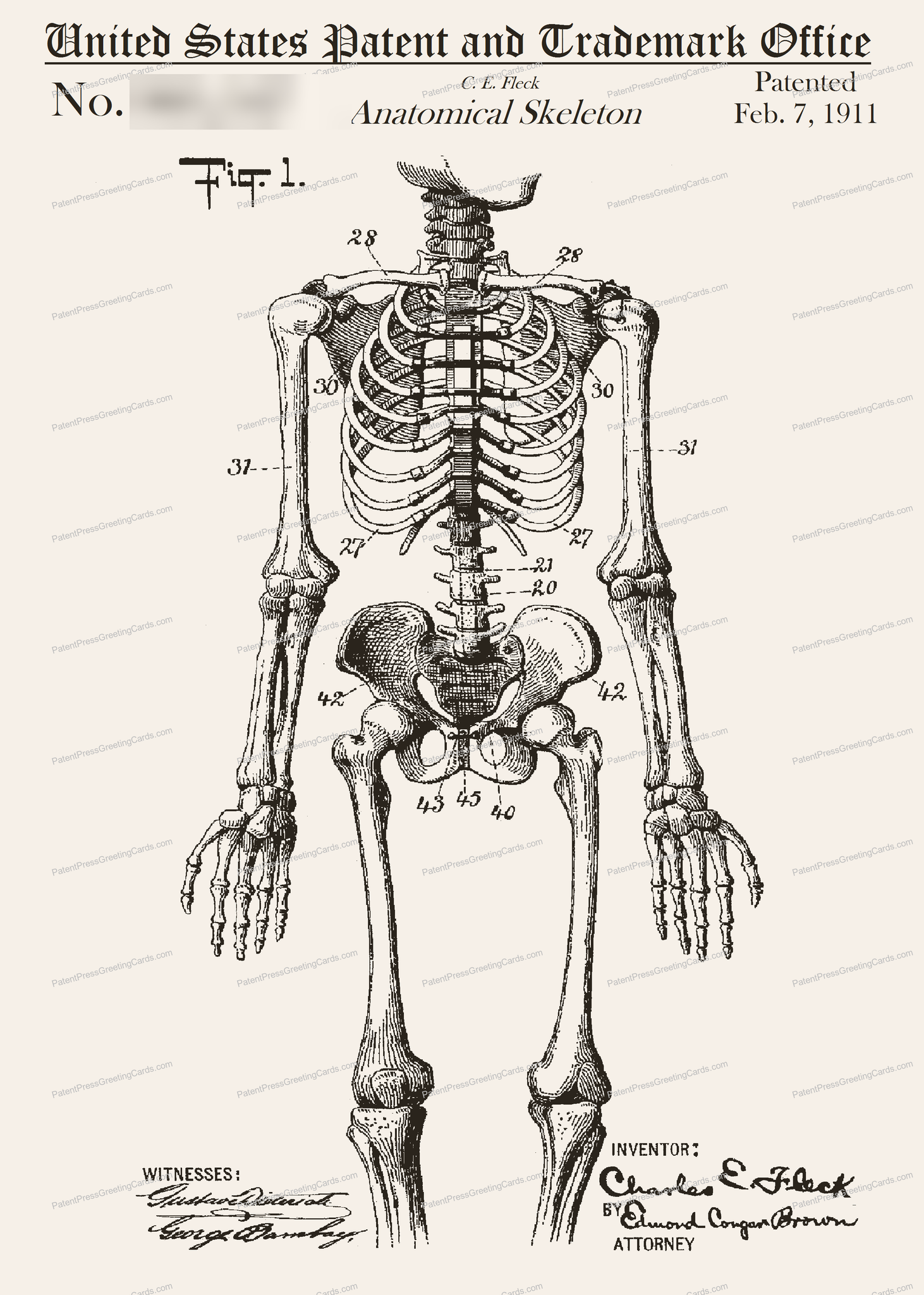 Skeleton