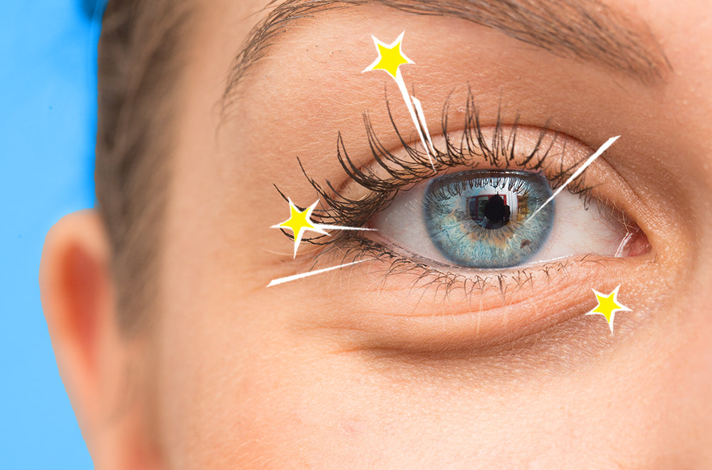 5 Typen Von Augenringen Und Was Du Dagegen Tun Kannst Makeupradierer