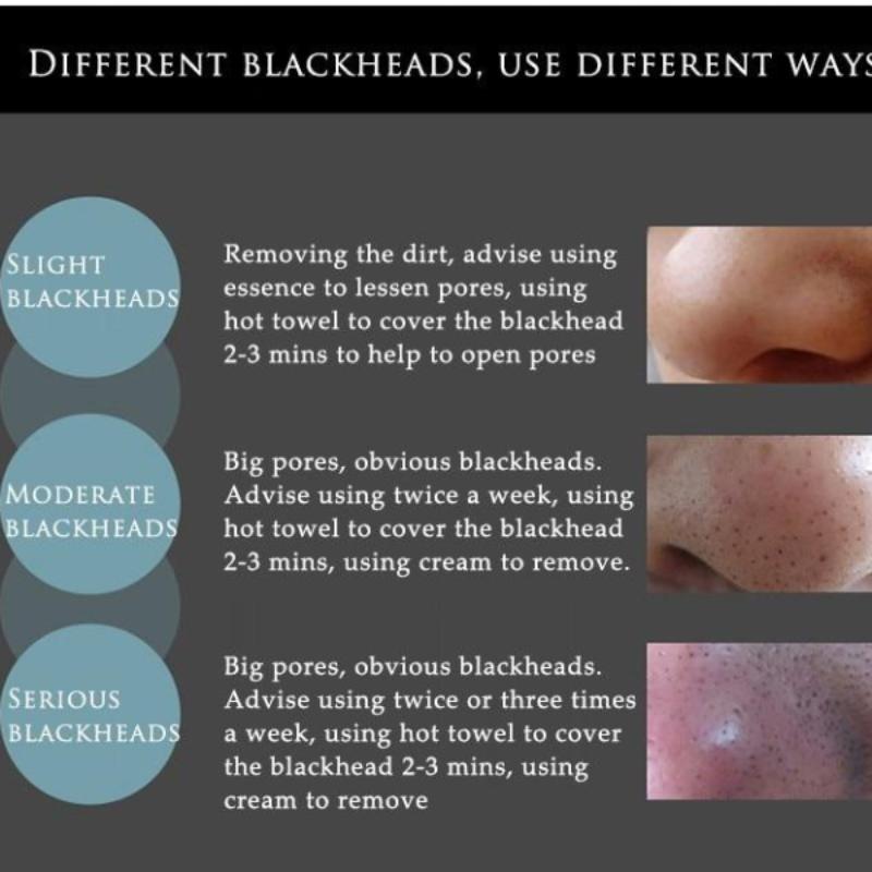 Black Suction Activated Carbon Remove Blackhead Mask