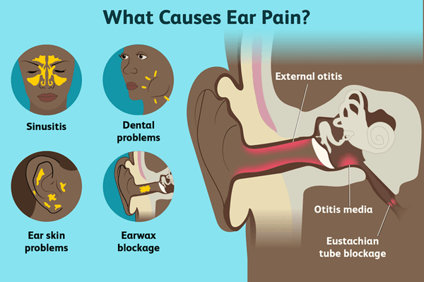 Can Toothache Cause Ear Pain