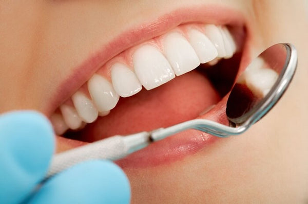 Preventing Tooth Abscesses and Maintaining Good Oral Health