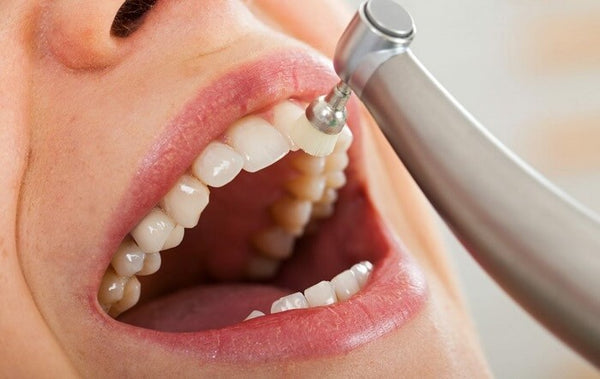 Professional Teeth Cleaning