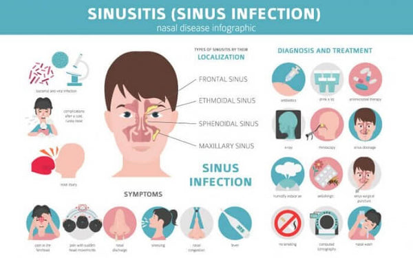Symptoms of Sinus Infection