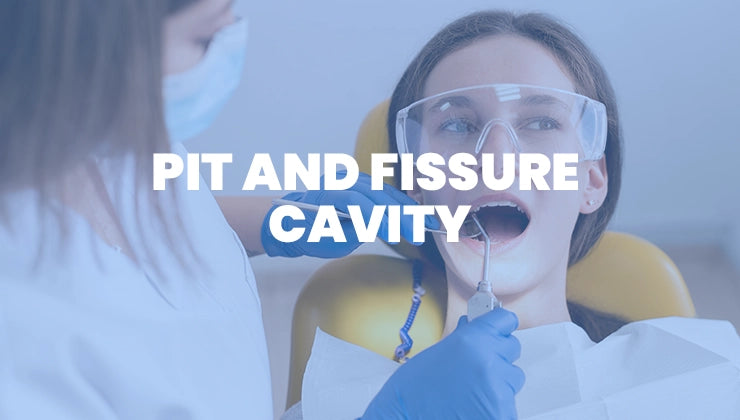 Pit and Fissure Cavity