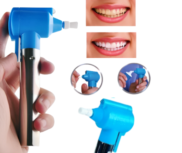 Luma Smile Teeth Whitening and Polishing Device 4