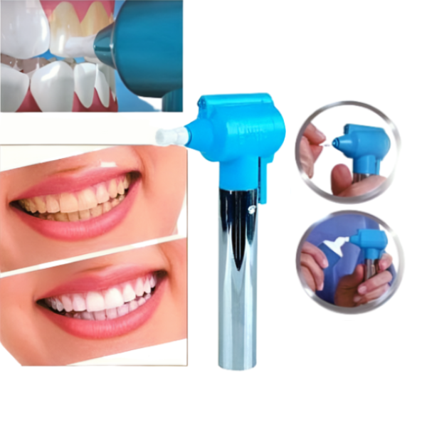 Luma Smile Teeth Whitening and Polishing Device 3