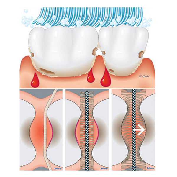 Glamza Interdental Brushes 3