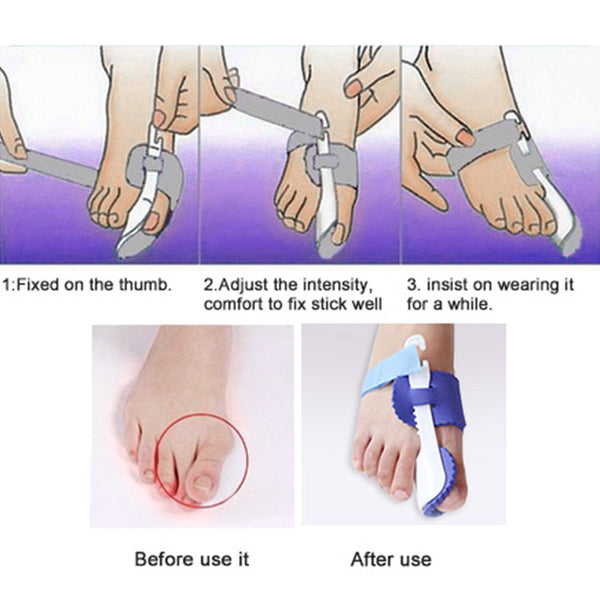 Glamza Splint Corrector Device Pair 4