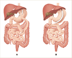 Digestion