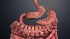 Sleeve Gastrectomy