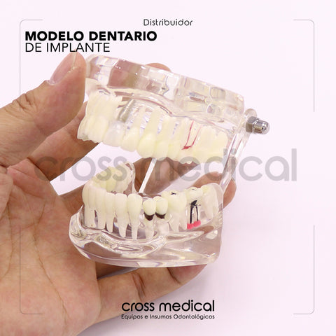 0239 CUÑAS DE MADERA x200und – crossmedical