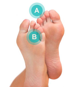 Photo diagram of pain in toe and ball of foot areas