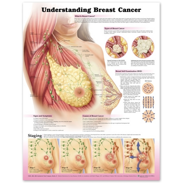 Understanding Breast Cancer 3E Paper