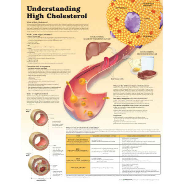 Understanding High Cholesterol Paper None Paper