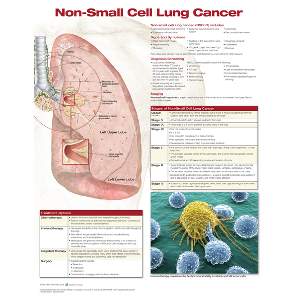 Non Small Cell Lung Cancer Anatomical Chart