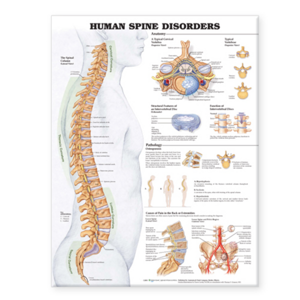 Human Spine Disorders Anatomical Chart