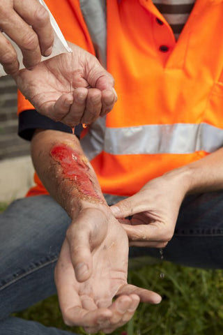 injured construction worker image | Shop at The Sign Shed