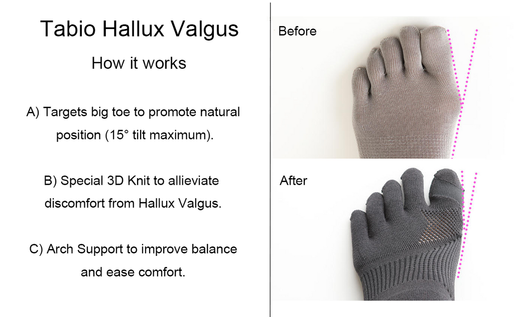 hallux valgus bunion socks