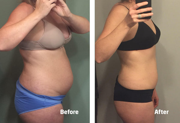 Postpartum Girdles Recovery Belly - UpTurn