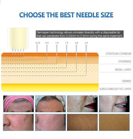 Micro Needling Derma Pen