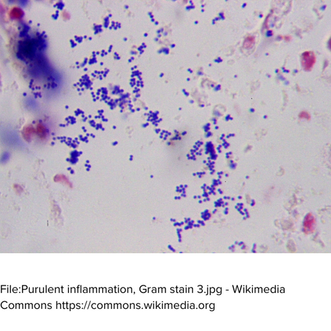 Gram-Positive Stain Example