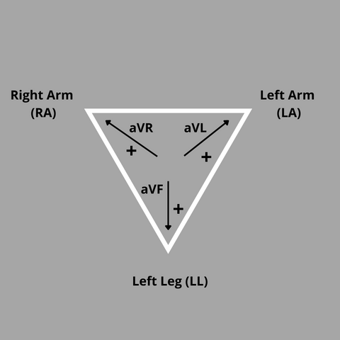 12 lead ecg eithoven triangle