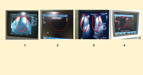 Scanning Images of Transducer Issue