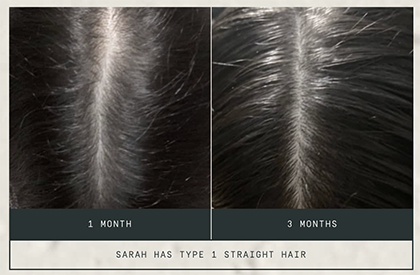 Prose Root Source before-and-after hair image