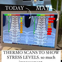 What Is Upper Cervical Chiropractic?