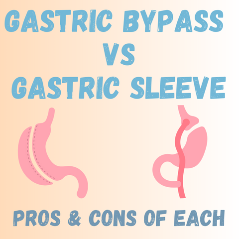 gastric bypass vs gastric sleeve, which is better