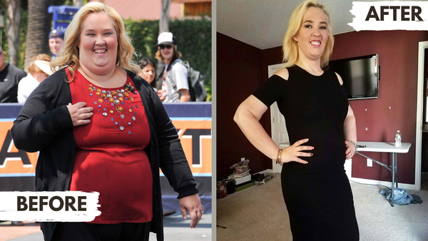 Mama June Before and After Bariatric Surgery