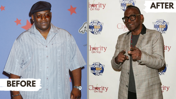 Randy Jackson before and after bariatric surgery