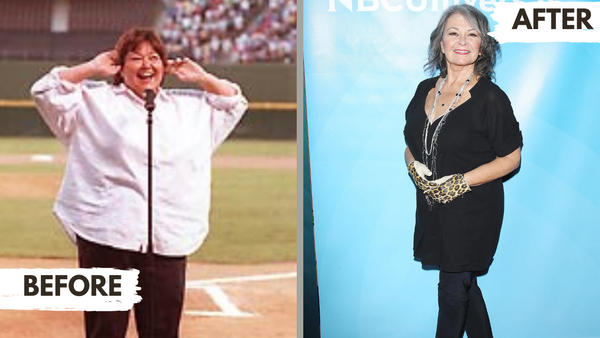 Roseanne Barr Before and After Bariatric Surgery