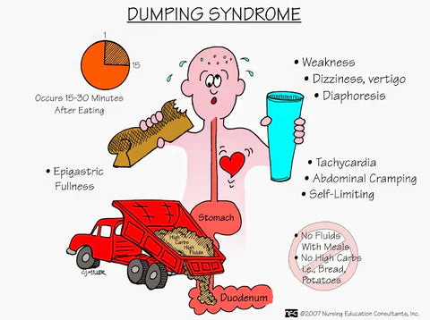 dumping syndrome from sugary foods