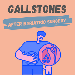 gallstones from bariatric surgery