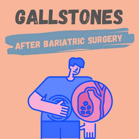 gallstones after weight loss surgery