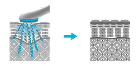 Diagram - LEAF Fusion Plasma stratum corneum passage