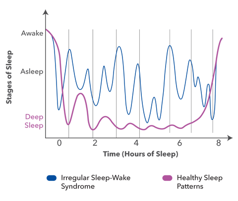 Comparison of sleep patterns_EN-02.png__PID:94bbfe0d-ea40-4021-ba0c-29b16e6c60dd