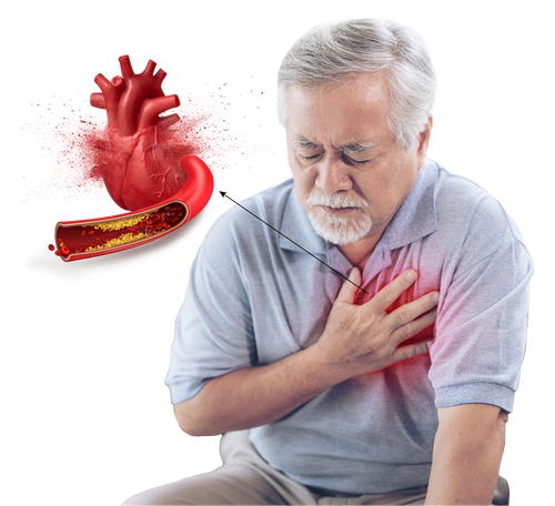 Heart Disease-02.png__PID:8c190187-0868-4ffb-bf37-9189a30f1733