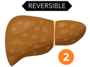 Liver 2-02.png__PID:37665ab6-5bed-460a-8ef8-dc84b098f7a1