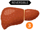 Liver 3-02.png__PID:665ab65b-ed06-4ace-b8dc-84b098f7a134