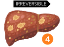 Liver 4-02.png__PID:5ab65bed-060a-4ef8-9c84-b098f7a134fc