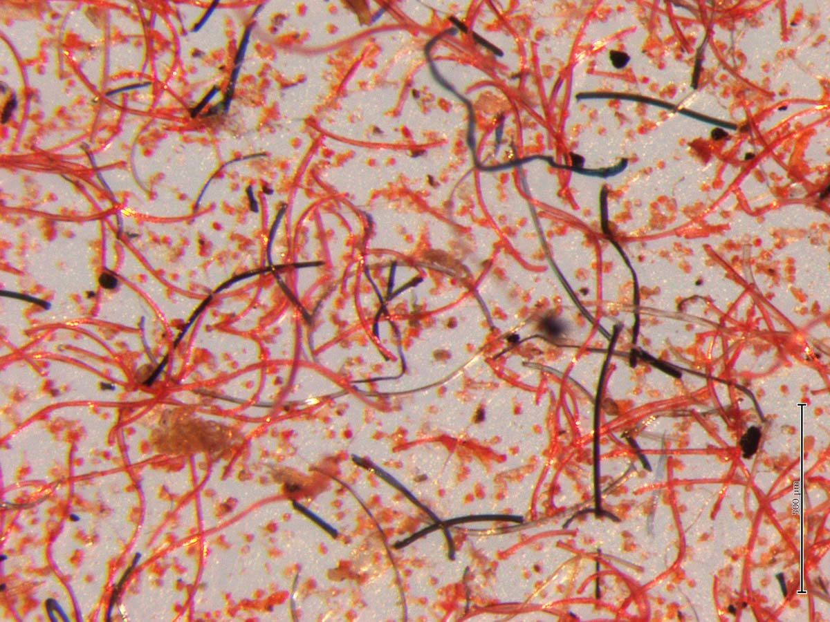 Image of microplastic under microscope