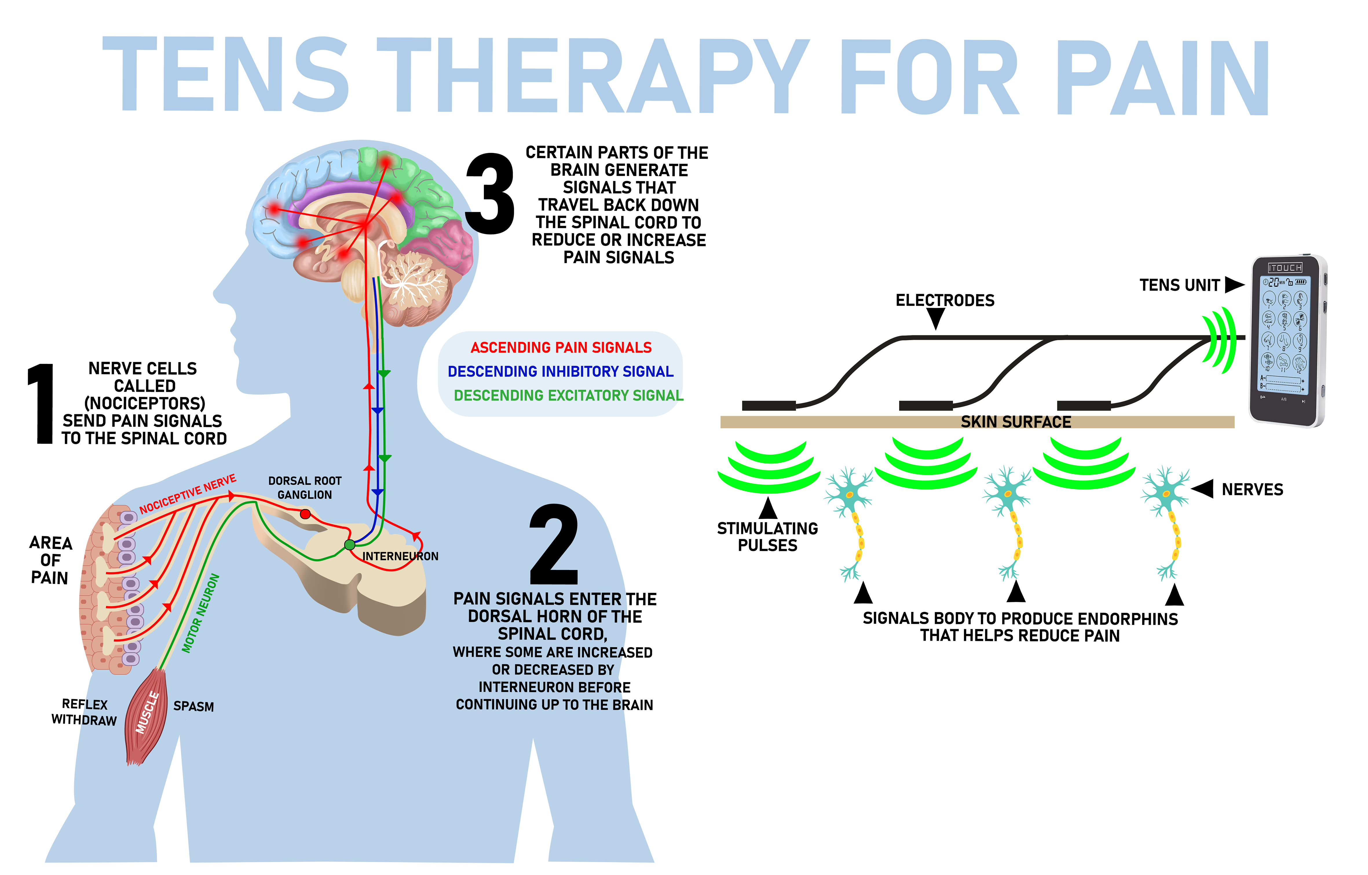 Electrotherapy For Acute Hip Pain – ITOUCH-SA