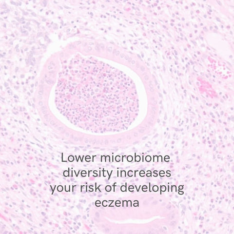 gut microbiome