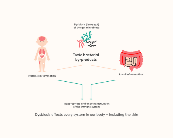 dysbiosis of the gut