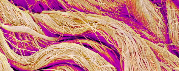 collagen fibers under microscope