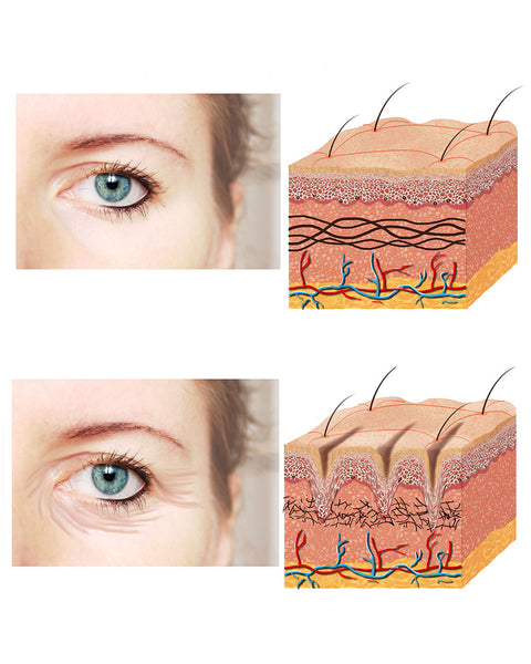 skin before and after of collagen loss