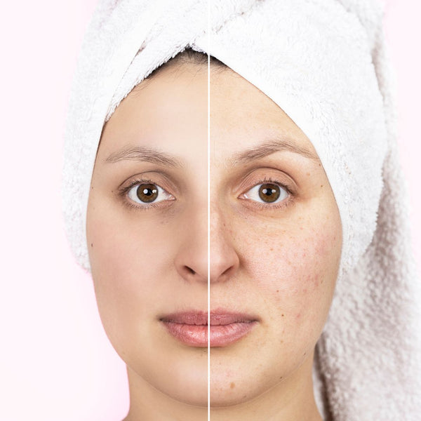 woman skin before and after